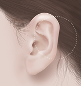 귓바퀴 필러 Before